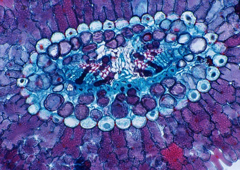 无人,横图,室内,特写,白天,正面,神秘,微生物,阴影,反射,科学,医学,细胞,影子,紫色,生物学,优美,庄重,高贵,消极,冷色,显微图片,自然科学,博物学,生物科学,孤寂,彩图,奢华
