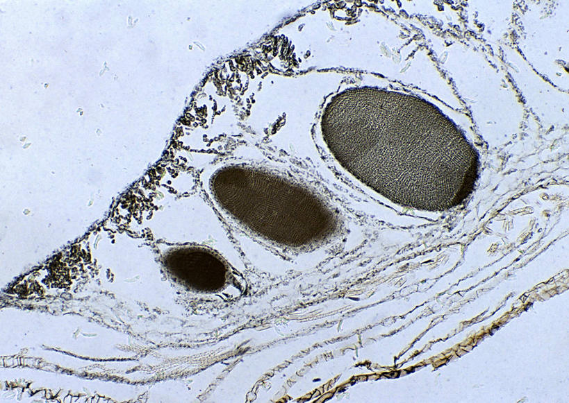 无人,横图,室内,特写,白天,白色背景,正面,微生物,阴影,反射,科学,医学,细胞,影子,灰色,生物学,柔和,大方,细致,中间色,朴素,平稳,显微图片,自然科学,博物学,生物科学,彩图