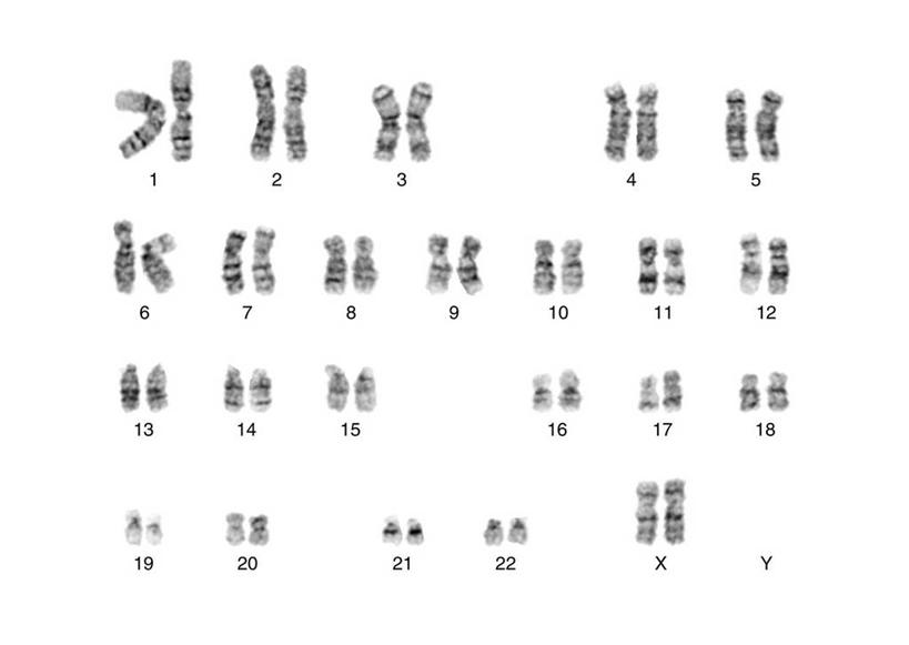 无人,横图,黑白,照片,室内,白天,白色背景,正面,一排,许多,整齐,并列,并排,科学,基因,细胞核,染色体,排列,生物,摄影,遗传,生物学,脱氧核糖核酸,队列,蛋白质,平行,核糖核酸,染色质,遗传信息,遗传因子,遗传学,自然科学,X染色体,性染色体,博物学,生物科学,相片,拍摄,照相