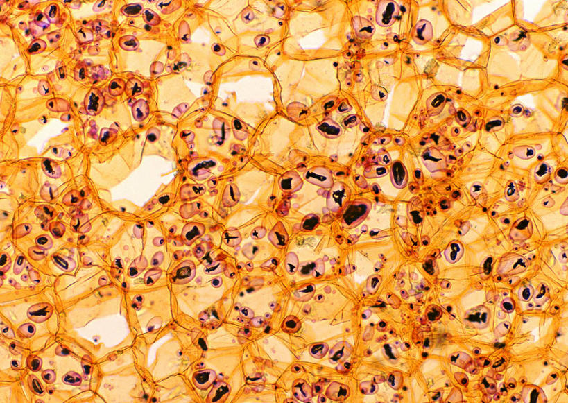 无人,横图,俯视,室内,特写,白天,仪器,微生物,土豆,许多,检查,反射,分析,科学,医学,圆形,粉末,细胞,显微镜,调料,调味品,很多,调味料,黄色,红色,观察,粉,清晰,探索,放大,观看,仔细,透镜,生物学,凸透镜,聚焦,关注,淀粉,光学,清楚,粉状,芡粉,团粉,显微图片,芋艿,洋芋,山药蛋,马铃薯,彩图,高角度拍摄