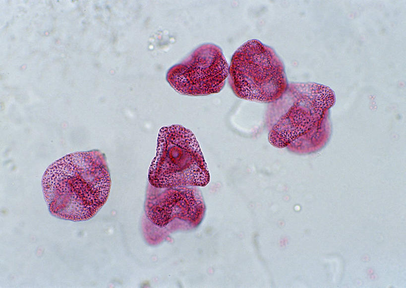 无人,横图,俯视,室内,特写,白天,仪器,海胆,微生物,许多,检查,反射,分析,科学,医学,圆形,细胞,显微镜,很多,粉色,白色,观察,清晰,探索,放大,观看,仔细,透镜,生物学,凸透镜,聚焦,关注,光学,清楚,刺锅子,海刺猬,显微图片,彩图,高角度拍摄