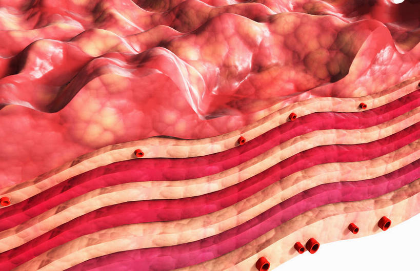 腹部,内脏,胃,动脉,静脉,无人,横图,插画,室内,白天,白色背景,正面,数码,科技,静物,阴影,网络,医学,高光,几何,计算机图形,合成,图画,画,红色,模型,人体,电脑合成图,数码合成图,疾病,生物学,人体器官,器官,漫画,生理学,写实,具体,具象,溃疡,胃部,彩图