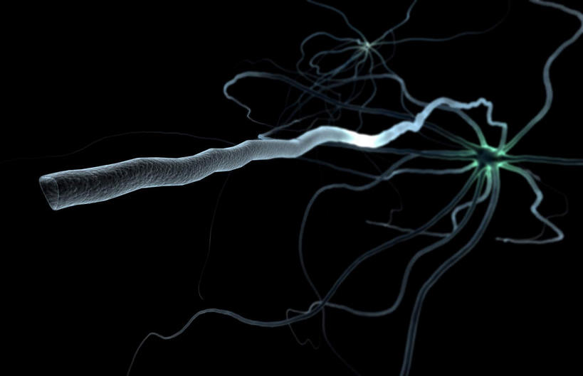 无人,横图,插画,室内,特写,白天,正面,数码,科技,静物,阴影,黑色背景,网络,医学,细胞,高光,几何,计算机图形,合成,图画,画,人体,电脑合成图,数码合成图,生物学,漫画,生理学,写实,具体,具象,神经纤维,轴突,彩图,神经系统