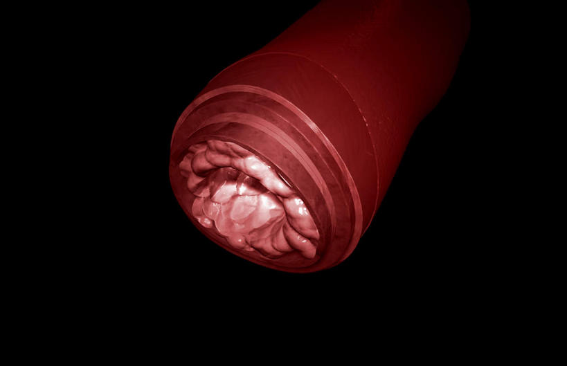 血管,无人,横图,插画,室内,特写,白天,正面,数码,科技,静物,阴影,黑色背景,网络,医学,细胞,高光,几何,计算机图形,合成,图画,画,人体,电脑合成图,数码合成图,生物学,漫画,生理学,写实,具体,具象,动脉硬化,动脉粥样硬化,血管病,彩图