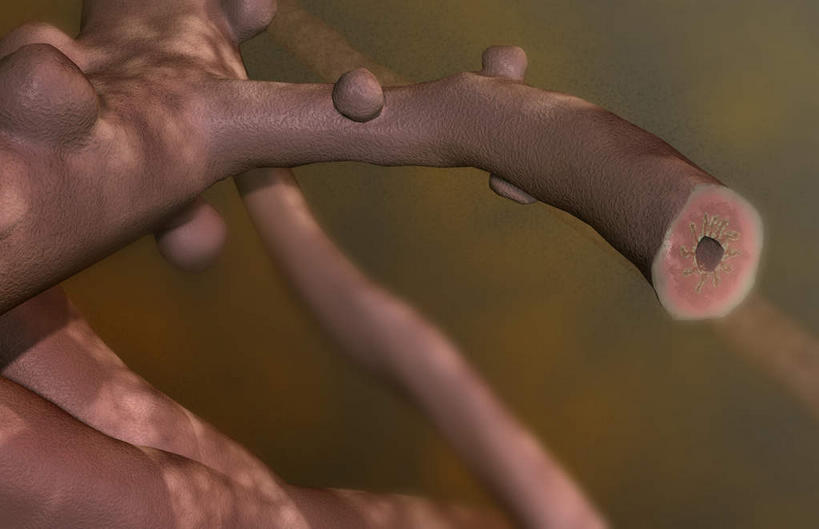 内脏,肺,气管,动脉,静脉,无人,横图,插画,室内,特写,白天,白色背景,正面,数码,科技,静物,阴影,网络,医学,高光,几何,计算机图形,合成,图画,画,模型,人体,电脑合成图,数码合成图,疾病,生物学,人体器官,器官,哮喘,漫画,生理学,写实,具体,具象,肺部,肺脏,彩图