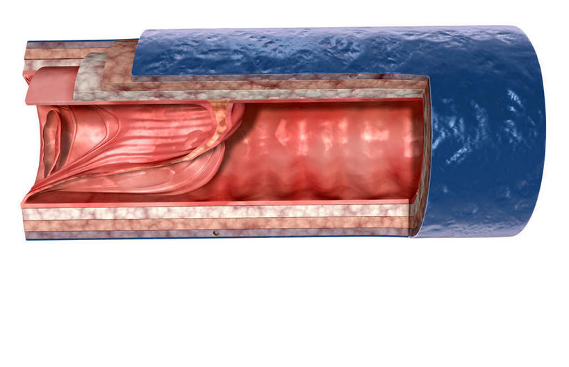 无人,横图,插画,室内,特写,白天,白色背景,正面,数码,科技,阴影,网络,医学,高光,几何,计算机图形,合成,图画,画,血液,电脑合成图,数码合成图,生物学,漫画,生理学,写实,具体,具象,静脉瓣膜,静脉壁,彩图