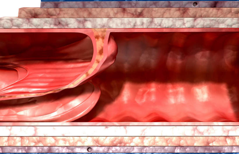 无人,横图,插画,室内,特写,白天,白色背景,正面,数码,科技,阴影,网络,医学,高光,几何,计算机图形,合成,图画,画,血液,电脑合成图,数码合成图,生物学,漫画,生理学,写实,具体,具象,静脉瓣膜,静脉壁,彩图,血管壁