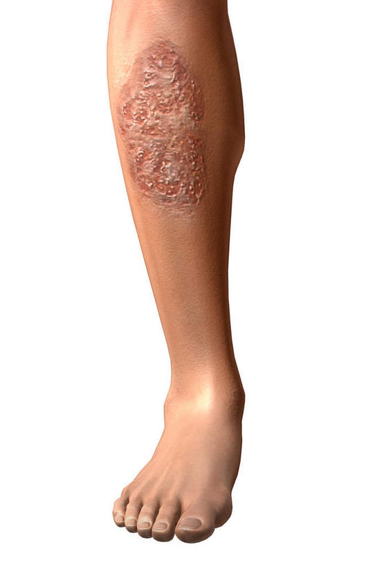 骨骼,肌肉,健壮,无人,竖图,插画,室内,特写,白天,白色背景,正面,抽象,数码,科技,阴影,网络,骨头,高光,几何,计算机图形,合成,图画,画,健康,活力,夸张,力量,青春,电脑合成图,数码合成图,骨架,强壮,特效,漫画,癌症,深奥,溃疡,皮肤癌,致命,彩图