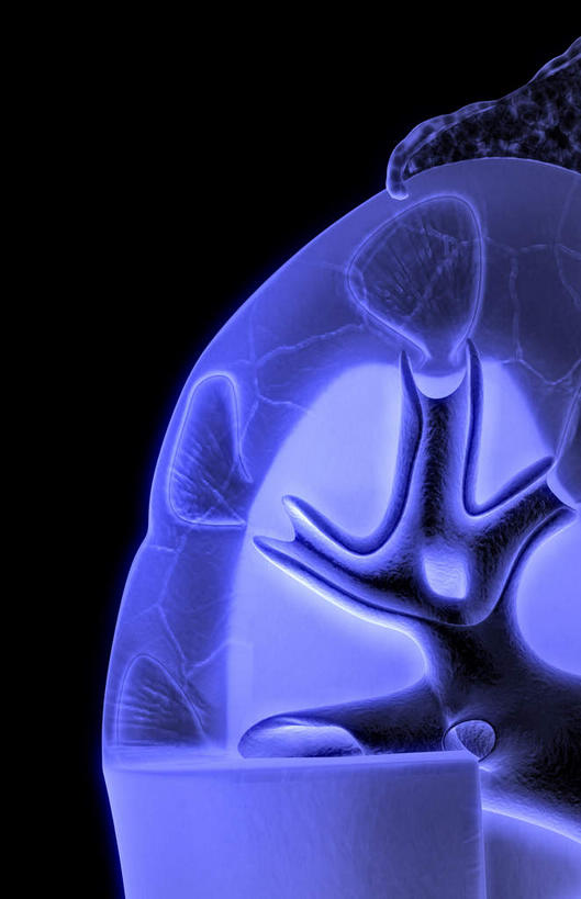 内脏,肾脏,动脉,静脉,无人,竖图,插画,室内,特写,白天,正面,数码,科技,静物,阴影,黑色背景,局部,网络,医学,光芒,高光,几何,计算机图形,合成,图画,画,蓝色,模型,人体,部分,电脑合成图,数码合成图,生物学,人体器官,器官,漫画,生理学,写实,具体,具象,髓质,肾皮质,肾髓质,彩图