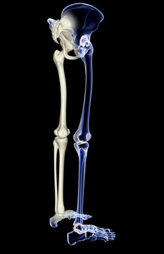 动脉,静脉,骨骼,骨盆,无人,医院,竖图,插画,x光片,室内,特写,白天,正面,数码,科技,静物,阴影,局部,辐射,科学,网络,医学,骨头,高光,几何,计算机图形,合成,图画,画,模型,人体,部分,电脑合成图,数码合成图,骨架,医疗,生物学,科学技术,x射线,x光,漫画,医疗机构,生理学,写实,具体,具象,髌骨,骶骨,腓骨,跗骨,股骨,胫骨,髋骨,尾骨,趾骨,胯骨,蹠骨,半身,彩图,病院,诊所,电磁波,电磁辐射