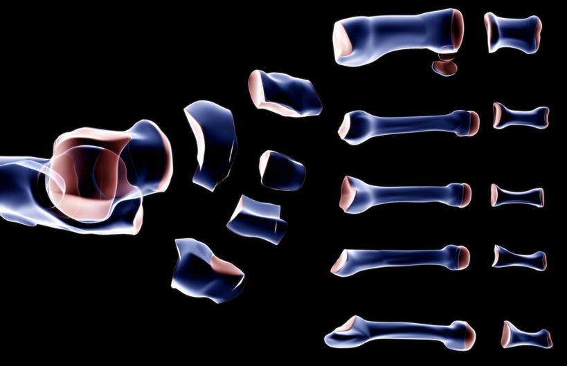 动脉,静脉,骨骼,无人,医院,横图,插画,x光片,室内,特写,白天,正面,数码,科技,静物,阴影,局部,辐射,科学,网络,医学,骨头,高光,几何,计算机图形,合成,图画,画,模型,人体,部分,电脑合成图,数码合成图,骨架,医疗,生物学,科学技术,x射线,骨折,x光,漫画,医疗机构,生理学,写实,具体,具象,跗骨,趾骨,跖骨,蹠骨,半身,彩图,病院,诊所,电磁波,电磁辐射