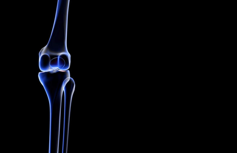 动脉,静脉,骨骼,无人,医院,横图,插画,x光片,室内,特写,白天,正面,数码,科技,静物,阴影,局部,辐射,科学,网络,医学,骨头,高光,几何,计算机图形,合成,图画,画,模型,人体,部分,电脑合成图,数码合成图,骨架,医疗,生物学,科学技术,x射线,x光,漫画,医疗机构,生理学,写实,具体,具象,髌骨,内上髁,外侧髁,外上髁,半身,彩图,病院,诊所,电磁波,电磁辐射