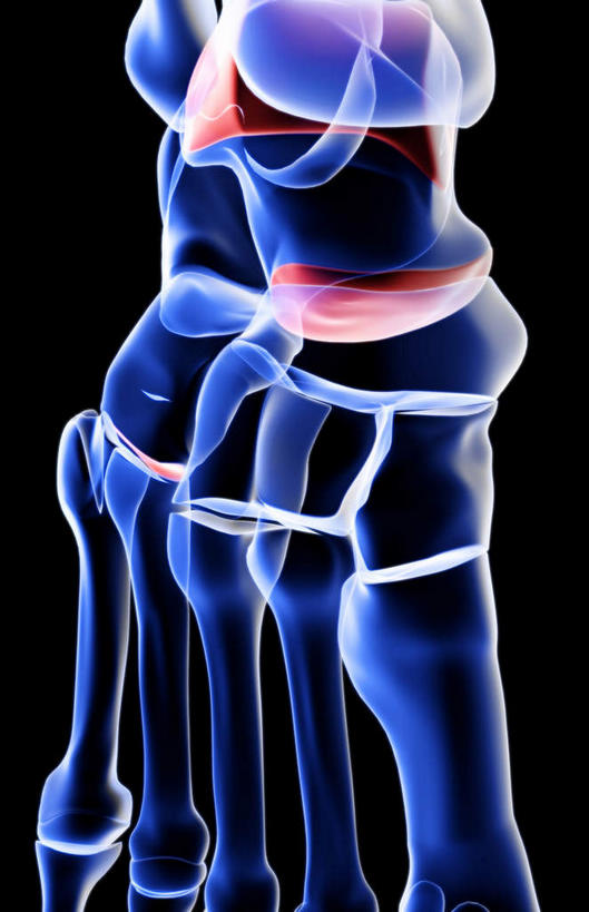 动脉,静脉,骨骼,无人,医院,竖图,插画,x光片,室内,特写,白天,正面,数码,科技,静物,阴影,局部,辐射,科学,网络,医学,骨头,高光,几何,计算机图形,合成,图画,画,模型,人体,部分,电脑合成图,数码合成图,骨架,医疗,生物学,科学技术,x射线,x光,漫画,医疗机构,生理学,写实,具体,具象,趾骨,跖骨,足骨,裸关节,半身,彩图,病院,诊所,电磁波,电磁辐射