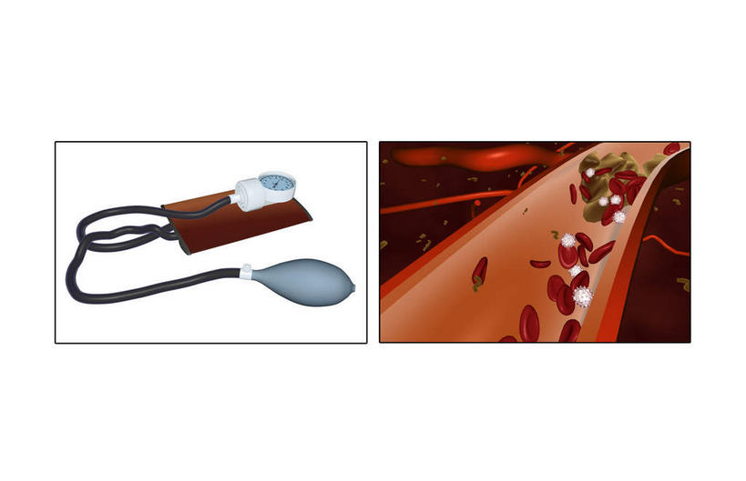 内脏,动脉,静脉,无人,横图,插画,室内,白天,白色背景,正面,数码,科技,静物,阴影,网络,医学,测量,细胞,刻度,高光,几何,计算机图形,合成,图画,画,模型,人体,测量工具,电脑合成图,数码合成图,血压,医疗设备,生物学,人体器官,血压计,血细胞,器官,医疗器械,漫画,生理学,写实,具体,具象,量具,量仪,血压表,纤维蛋白,彩图