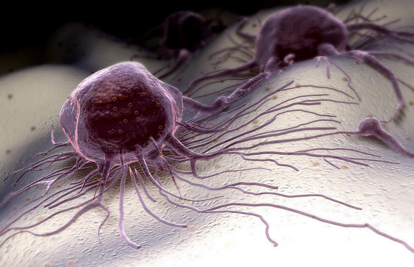 无人,横图,插画,室内,特写,白天,正面,数码,分子,科技,微生物,静物,阴影,黑色背景,网络,医学,高光,几何,计算机图形,合成,图画,画,生物,人体,电脑合成图,数码合成图,医疗,病毒,生物学,漫画,癌症,癌细胞,生理学,写实,具体,具象,寄生,生命体,肿瘤细胞,彩图