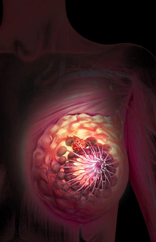 无人,竖图,插画,室内,特写,白天,正面,数码,分子,科技,微生物,静物,阴影,黑色背景,网络,医学,高光,几何,计算机图形,合成,图画,画,生物,人体,电脑合成图,数码合成图,医疗,病毒,生物学,肿瘤,乳腺癌,漫画,癌症,生理学,写实,具体,具象,寄生,生命体,肿瘤细胞,彩图