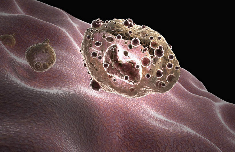 无人,横图,插画,室内,特写,白天,正面,数码,科技,静物,阴影,网络,医学,细胞,高光,几何,计算机图形,合成,图画,画,人体,电脑合成图,数码合成图,生物学,漫画,生理学,写实,具体,具象,淋巴系统,淋巴细胞,淋巴,淋巴管,淋巴液,淋巴组织,免疫组织,彩图