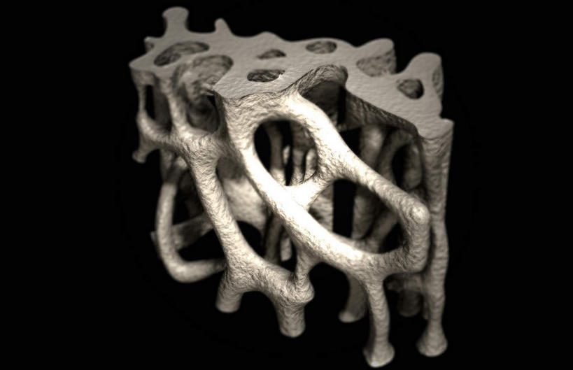 无人,横图,插画,室内,特写,白天,正面,数码,科技,静物,阴影,网络,医学,高光,几何,计算机图形,合成,图画,画,人体,电脑合成图,数码合成图,生物学,漫画,生理学,写实,具体,具象,骨质疏松,彩图