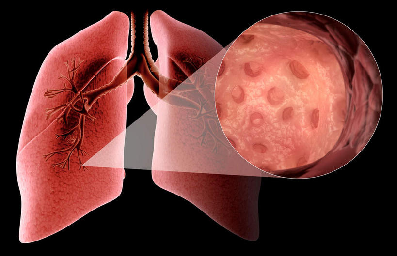 内脏,肺,动脉,静脉,无人,横图,插画,室内,白天,正面,数码,科技,静物,阴影,黑色背景,网络,医学,高光,几何,计算机图形,合成,图画,画,红色,模型,人体,电脑合成图,数码合成图,生物学,人体器官,器官,哮喘,漫画,过敏,呼吸道,支气管,生理学,写实,具体,具象,呼吸系统,赤色,肺部,肺脏,彩图