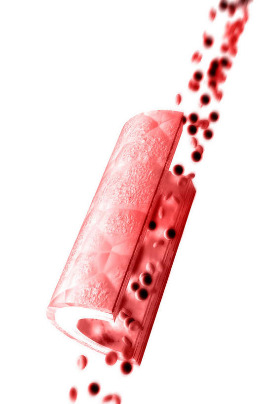 无人,竖图,插画,室内,特写,白天,白色背景,正面,数码,科技,静物,阴影,网络,红血球,医学,细胞,高光,几何,计算机图形,合成,图画,画,人体,电脑合成图,数码合成图,生物学,血细胞,破裂,分裂,漫画,生理学,写实,具体,具象,红细胞,割裂,盘据,彩图,决裂