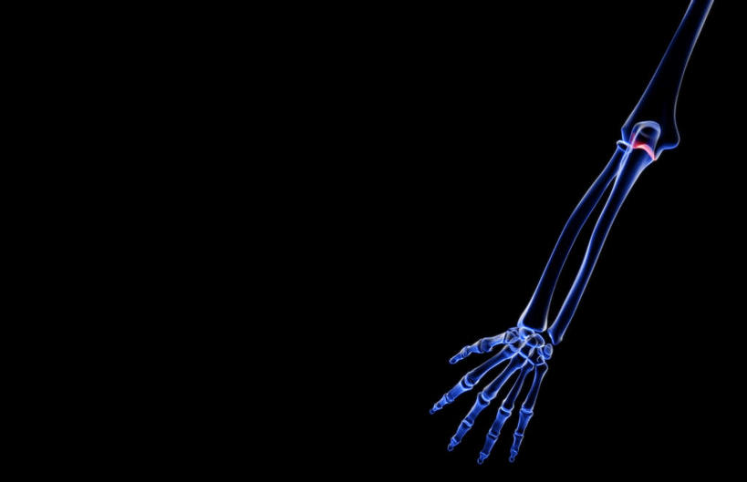 手,动脉,静脉,骨骼,无人,横图,插画,x光片,室内,特写,白天,正面,数码,科技,静物,阴影,黑色背景,发光,辐射,科学,网络,医学,骨头,高光,几何,计算机图形,合成,图画,画,蓝色,模型,手部,手指,人体,电脑合成图,数码合成图,骨架,医疗,生物学,科学技术,x射线,x光,漫画,生理学,写实,具体,具象,掌骨,钩骨,月骨,半身,彩图,电磁波,电磁辐射