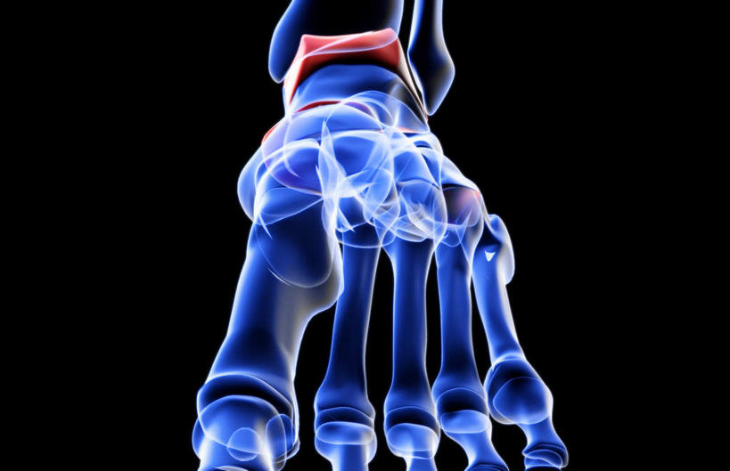 腿部,脚,脚趾,脚趾甲,腿,无人,横图,插画,x光片,室内,白天,正面,数码,科技,阴影,黑色背景,发光,辐射,科学,网络,医学,高光,几何,计算机图形,合成,图画,画,紫色,电脑合成图,数码合成图,医疗,科学技术,x射线,x光,漫画,写实,具体,具象,手舟骨,跖骨,脚指甲,彩图,电磁波,电磁辐射