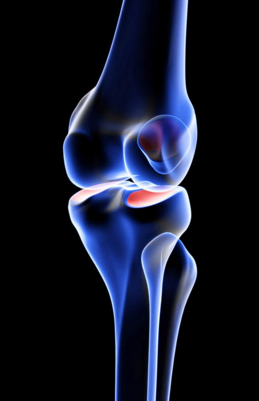 动脉,静脉,骨骼,无人,竖图,插画,x光片,室内,白天,正面,数码,科技,静物,阴影,黑色背景,辐射,科学,网络,医学,骨头,高光,几何,计算机图形,合成,图画,画,模型,人体,电脑合成图,数码合成图,骨架,医疗,生物学,科学技术,x射线,x光,漫画,生理学,写实,具体,具象,髌骨,髁骨,内上髁,外侧髁,外上髁,彩图,电磁波,电磁辐射