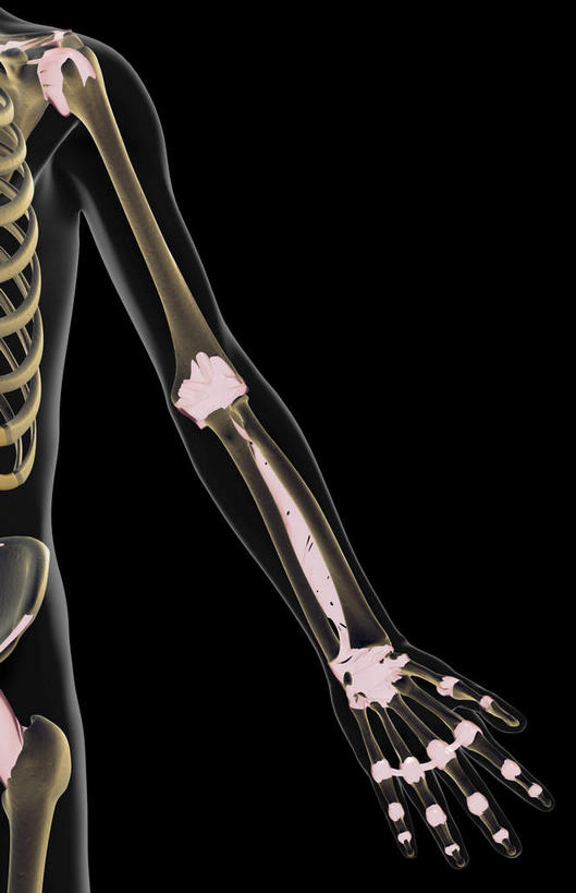 无人,站,横图,插画,x光片,室内,白天,正面,数码,科技,阴影,黑色背景,辐射,科学,网络,医学,高光,几何,计算机图形,合成,图画,画,站着,皮肤,电脑合成图,数码合成图,医疗,科学技术,x射线,x光,韧带,漫画,写实,具体,具象,手臂,站立,彩图,电磁波,电磁辐射