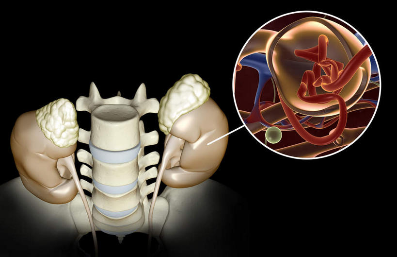 内脏,动脉,静脉,无人,横图,插画,室内,白天,正面,数码,科技,静物,阴影,黑色背景,网络,医学,高光,几何,计算机图形,合成,图画,画,红色,模型,人体,电脑合成图,数码合成图,生物学,人体器官,解剖,器官,漫画,生理学,写实,具体,具象,彩图,剖解,肾小球