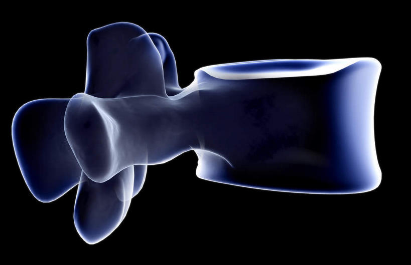 脊髓,骨骼,无人,横图,x光片,室内,白天,正面,数码,科技,阴影,黑色背景,发光,辐射,科学,网络,医学,骨头,高光,几何,计算机图形,合成,一个,蓝色,单个,电脑合成图,数码合成图,骨架,医疗,科学技术,x射线,x光,写实,具体,具象,腰椎,脊柱,彩图,电磁波,电磁辐射