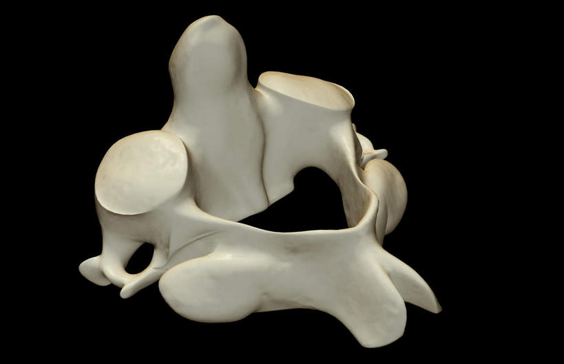 骨骼,无人,横图,x光片,室内,白天,正面,数码,科技,阴影,黑色背景,辐射,科学,网络,医学,骨头,高光,几何,计算机图形,合成,一个,单个,电脑合成图,数码合成图,骨架,医疗,科学技术,x射线,x光,写实,具体,具象,颈椎骨,轴骨,彩图,电磁波,电磁辐射