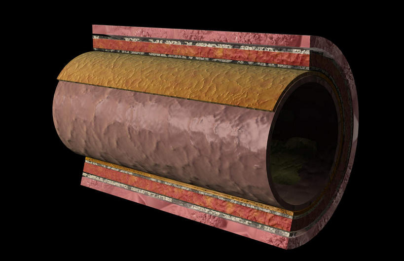内脏,动脉,静脉,血管,无人,横图,室内,特写,白天,正面,数码,科技,静物,阴影,黑色背景,网络,医学,高光,几何,计算机图形,合成,红色,模型,人体,电脑合成图,数码合成图,生物学,人体器官,器官,生理学,写实,具体,具象,动脉壁,彩图,血管壁