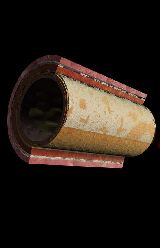 内脏,动脉,静脉,血管,无人,竖图,室内,特写,白天,正面,数码,科技,静物,阴影,黑色背景,网络,医学,高光,几何,计算机图形,合成,红色,模型,人体,电脑合成图,数码合成图,生物学,人体器官,器官,生理学,写实,具体,具象,动脉壁,彩图,血管壁