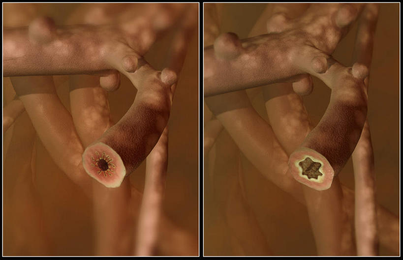 无人,横图,插画,室内,特写,白天,白色背景,正面,数码,科技,静物,阴影,网络,医学,细胞,高光,几何,计算机图形,合成,图画,画,人体,电脑合成图,数码合成图,生物学,哮喘,漫画,过敏,生理学,写实,具体,具象,呼吸系统,彩图