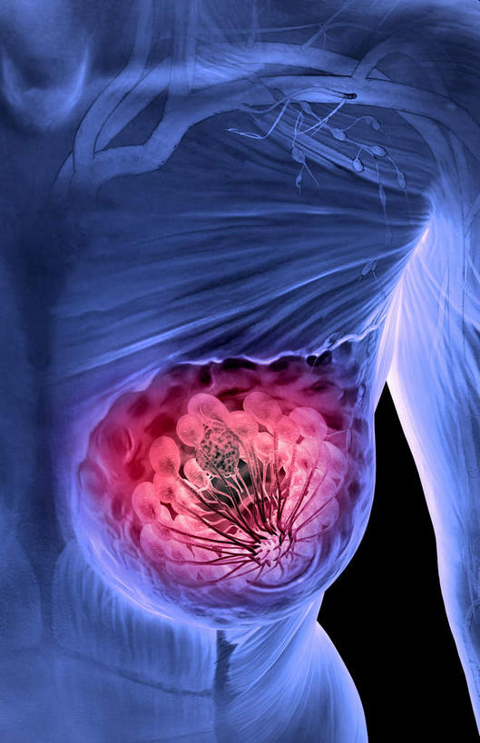 内脏,动脉,静脉,无人,竖图,插画,x光片,室内,特写,白天,正面,数码,科技,静物,阴影,黑色背景,辐射,科学,网络,医学,高光,几何,计算机图形,合成,图画,画,红色,蓝色,模型,人体,电脑合成图,数码合成图,医疗,生物学,人体器官,科学技术,x射线,器官,x光,漫画,癌症,生理学,写实,具体,具象,彩图,乳癌,电磁波,电磁辐射