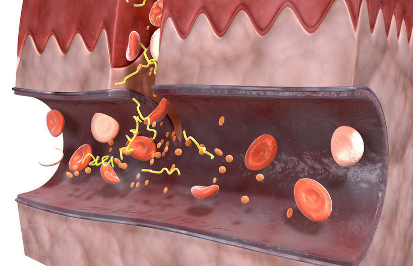 血管,无人,横图,插画,室内,特写,白天,正面,数码,科技,静物,阴影,黑色背景,网络,医学,细胞,高光,几何,计算机图形,合成,图画,画,人体,流动,皮肤,电脑合成图,数码合成图,生物学,血小板,破裂,受伤,漫画,流淌,生理学,写实,具体,具象,纤维蛋白,彩图