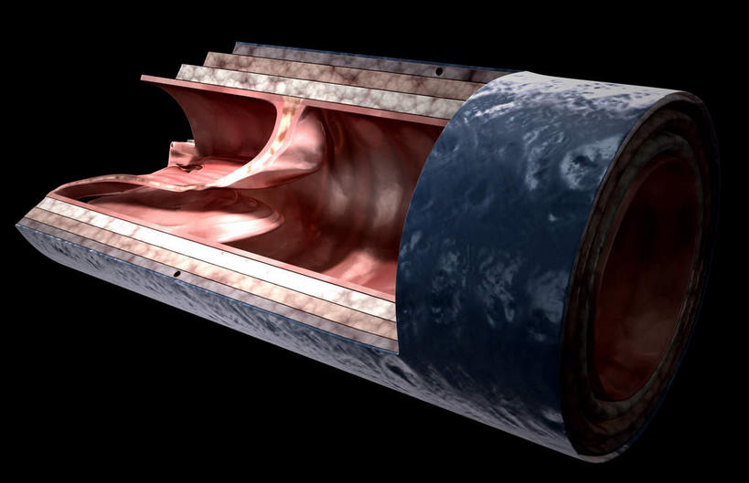 无人,横图,插画,室内,特写,白天,正面,数码,科技,静物,阴影,黑色背景,网络,医学,细胞,高光,几何,计算机图形,合成,图画,画,治疗,人体,电脑合成图,数码合成图,疾病,生物学,横截面,漫画,医治,生理学,写实,具体,具象,动脉硬化,动脉粥样硬化,血管病,彩图