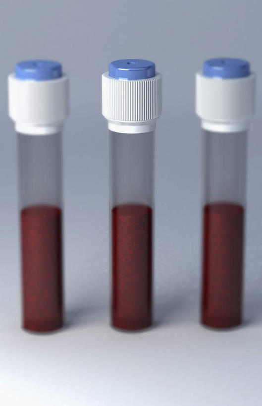 无人,竖图,插画,室内,白天,白色背景,正面,数码,实验,仪器,科技,杯子,阴影,研究,透明,分析,网络,化学,血,测试,盖子,试管,高光,几何,计算机图形,合成,图画,玻璃制品,画,红色,蓝色,白色,玻璃瓶,瓶子,器皿,电脑合成图,数码合成图,样品,三瓶,漫画,计量,玻璃仪器,试验耗材,实验用品,写实,具体,具象,玻璃杯,彩图