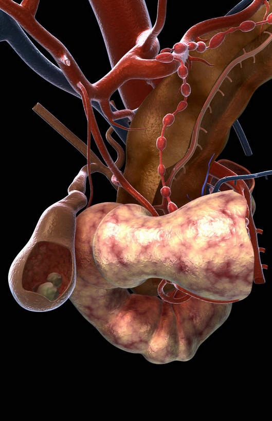 内脏,动脉,静脉,胆囊,无人,竖图,插画,室内,特写,白天,正面,数码,科技,石头,静物,阴影,黑色背景,网络,医学,石子,两颗,高光,几何,计算机图形,合成,图画,画,模型,人体,电脑合成图,数码合成图,生物学,人体器官,器官,漫画,生理学,写实,具体,具象,胆,胆结石,结石,石块,彩图