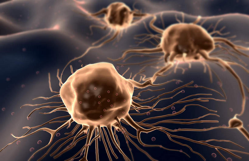 无人,横图,插画,室内,白天,正面,数码,科技,静物,阴影,网络,医学,细胞,高光,几何,计算机图形,合成,图画,画,三个,黄色,人体,电脑合成图,数码合成图,疾病,生物学,漫画,癌症,癌细胞,生理学,写实,具体,具象,彩图