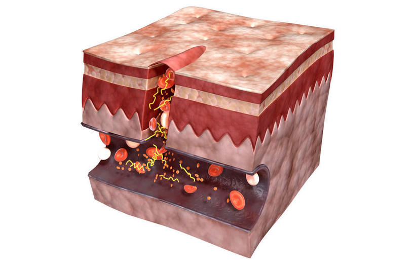 血管,无人,横图,插画,室内,特写,白天,白色背景,正面,数码,科技,静物,阴影,网络,医学,细胞,高光,几何,计算机图形,合成,图画,画,人体,流动,皮肤,电脑合成图,数码合成图,生物学,血小板,破裂,受伤,漫画,流淌,生理学,写实,具体,具象,纤维蛋白,彩图