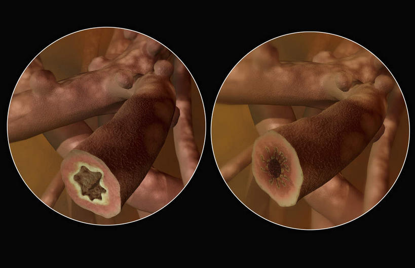 气管,无人,横图,插画,室内,特写,白天,正面,数码,科技,静物,阴影,网络,医学,细胞,高光,几何,计算机图形,合成,图画,画,红色,人体,电脑合成图,数码合成图,疾病,生物学,哮喘,漫画,支气管,生理学,写实,具体,具象,彩图