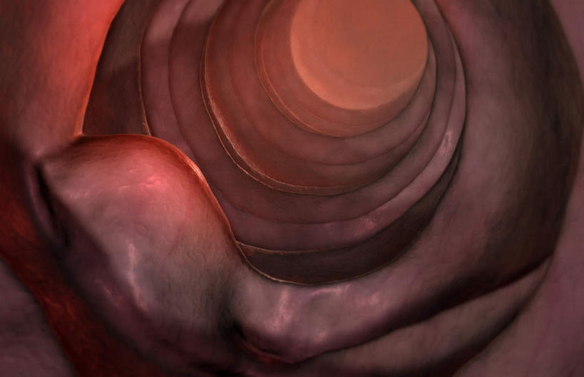 内脏,肠,十二指肠,无人,横图,插画,室内,特写,白天,正面,数码,科技,静物,阴影,网络,医学,细胞,高光,几何,计算机图形,合成,图画,画,人体,电脑合成图,数码合成图,生物学,人体器官,器官,漫画,癌症,癌细胞,生理学,写实,具体,具象,肠癌,大肠,盲肠,小肠,直肠,彩图