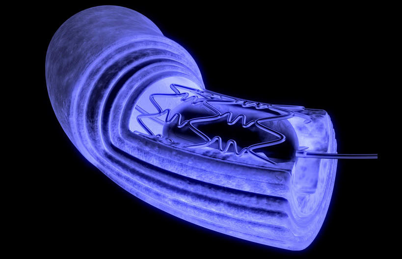 动脉,静脉,血管,无人,横图,插画,室内,特写,白天,白色背景,正面,数码,科技,静物,阴影,辐射,科学,网络,医学,高光,几何,计算机图形,合成,图画,画,模型,人体,电脑合成图,数码合成图,生物学,科学技术,x射线,x光,漫画,剖面,生理学,写实,具体,具象,动脉硬化,动脉粥样硬化,血管病,彩图,电磁波,电磁辐射