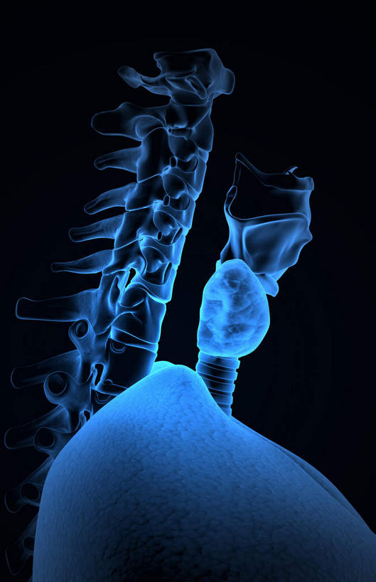 喉咙,内脏,气管,动脉,静脉,骨骼,无人,竖图,插画,x光片,室内,特写,白天,正面,数码,科技,静物,阴影,黑色背景,辐射,科学,网络,医学,支架,骨头,高光,几何,计算机图形,合成,图画,画,一个,模型,人体,单个,电脑合成图,数码合成图,骨架,医疗,生物学,人体器官,科学技术,x射线,器官,x光,漫画,软骨,生理学,写实,具体,具象,喉,彩图,电磁波,电磁辐射