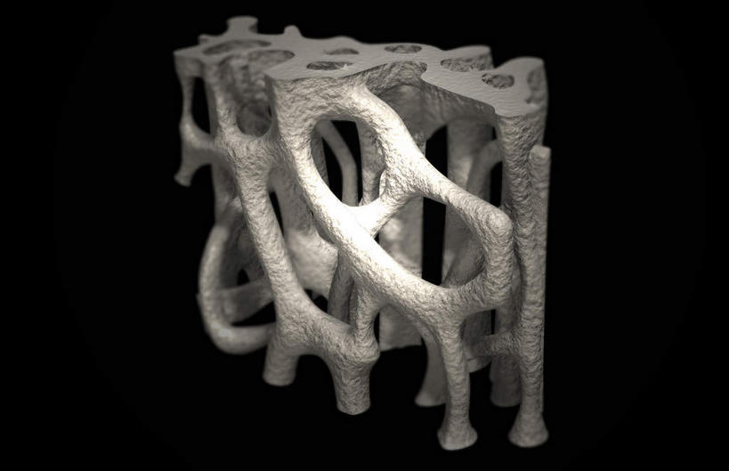 动脉,静脉,骨骼,无人,横图,插画,x光片,室内,特写,白天,正面,数码,科技,静物,一堆,阴影,堆叠,堆积,黑色背景,辐射,科学,网络,医学,支架,骨头,高光,几何,计算机图形,合成,图画,画,白色,模型,人体,堆,电脑合成图,数码合成图,骨架,生物学,科学技术,x射线,x光,漫画,生理学,写实,具体,具象,骨质疏松,彩图,电磁波,电磁辐射