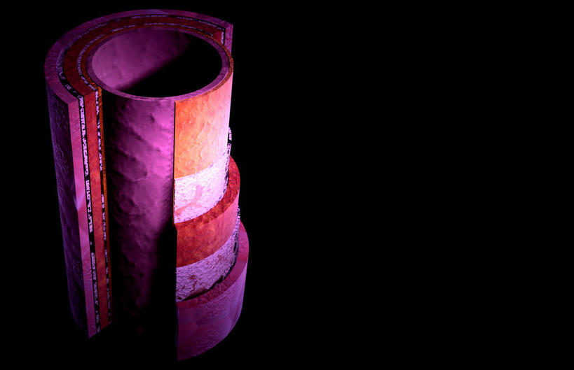 动脉,血管,无人,竖图,插画,室内,特写,白天,正面,数码,科技,静物,阴影,黑色背景,网络,医学,细胞,高光,几何,计算机图形,合成,图画,画,红色,人体,电脑合成图,数码合成图,生物学,漫画,生理学,写实,具体,具象,内膜,彩图,血管壁