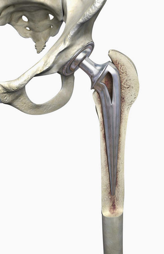 动脉,静脉,骨骼,骨盆,无人,竖图,插画,室内,特写,白天,白色背景,正面,数码,科技,静物,阴影,网络,医学,骨头,高光,几何,计算机图形,合成,图画,画,白色,模型,人体,电脑合成图,数码合成图,骨架,生物学,横截面,漫画,骨髓,生理学,写实,具体,具象,股骨,髋骨,尾骨,腰骨,彩图