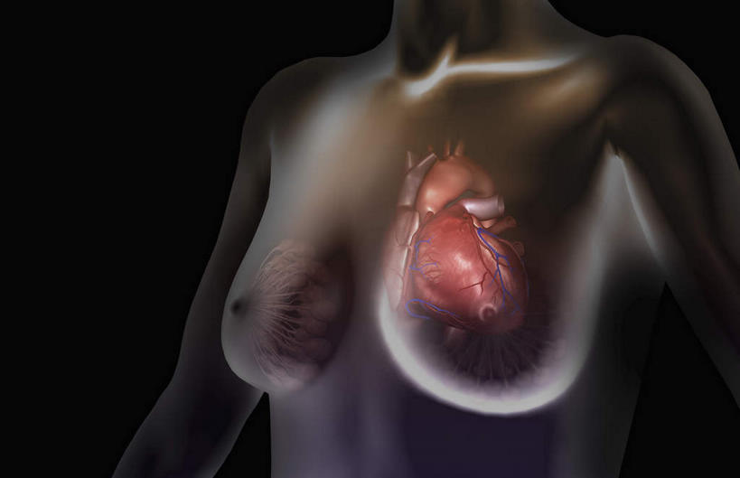 西方人,胸,内脏,心脏,动脉,静脉,一个人,无人,横图,插画,室内,白天,正面,数码,科技,静物,欧洲,欧洲人,仅一个年轻女性,仅一个女性,仅一个人,阴影,网络,高光,几何,计算机图形,合成,图画,画,模型,人体,电脑合成图,数码合成图,生物学,器官,漫画,心血管,心房,心室,生理学,写实,具体,具象,乳腺,年轻女性,女人,女性,白种人,心,胸部,半身,彩图