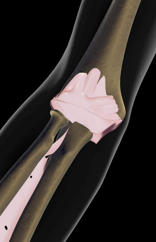 动脉,静脉,骨骼,无人,竖图,室内,特写,白天,正面,数码,科技,静物,阴影,黑色背景,局部,网络,医学,骨头,光芒,高光,几何,计算机图形,合成,模型,人体,部分,电脑合成图,数码合成图,骨架,生物学,韧带,生理学,写实,具体,具象,环状韧带,桡侧副韧带,半身,彩图